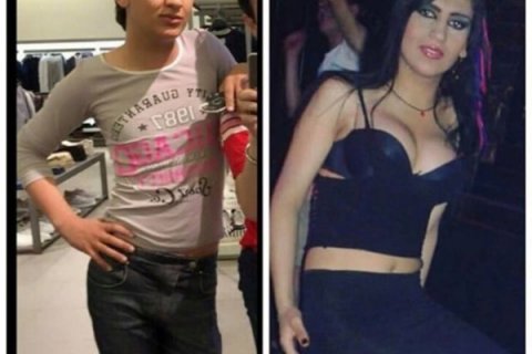 19 yaşlı azərbaycanlı cinsiyyətini dəyişdi: "14 yaşımda təcavüz ediblər"