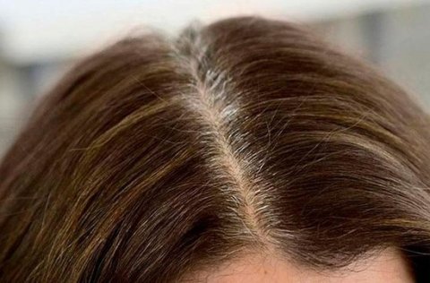 ​​​​​​​Saçın erkən ağarmasının əsas səbəblərindən biri