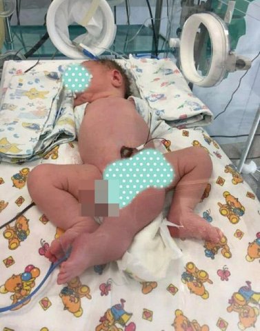 Rusiyada iki cinsiyyət orqanlı uşaq doğulub - ŞƏKİLLƏR