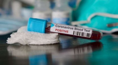 Koronavirus Rusiyaya gedib çatdı