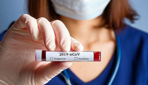 TƏBİB: Koronavirus testinin şəxsi istəyə bağlı olunmaması tövsiyə olunur