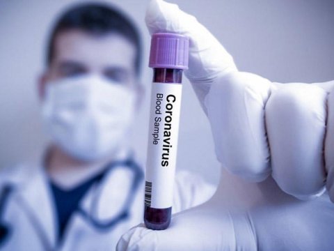 Azərbaycanda daha 17 nəfər koronavirusa yoluxub, 1 nəfər ölüb