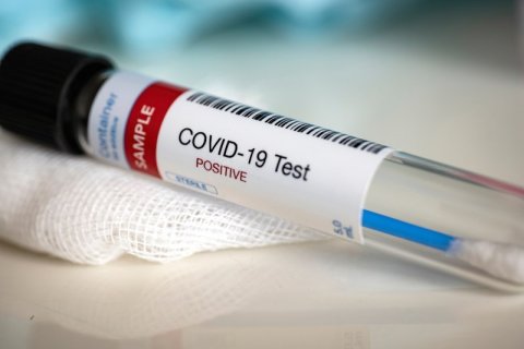 ABŞ-da nəticəsi 15 dəqiqəyə bilinən koronavirus testi hazırlanıb