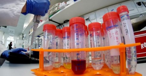 Azərbaycanda daha 65 nəfər koronavirusa yoluxdu, 1 nəfər öldü