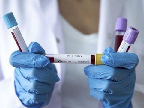 Almaniya koronavirusdan müalicə üçün dərmanın hazır olacağı tarixi açıqladı