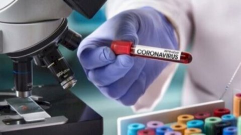 TƏBİB koronavirusla bağlı son vəziyyəti açıqladı - Şəkil