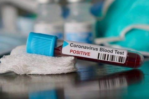 Azərbaycanda 56 nəfər yeni koronavirusa yoluxdu - SON RƏQƏMLƏR