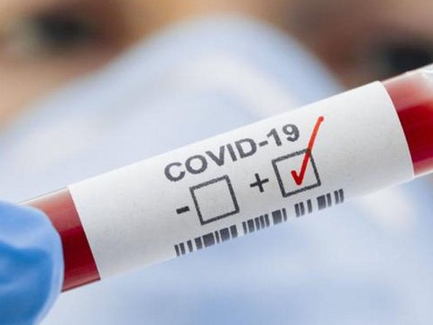 Milli Məclisin 2 əməkdaşında koronavirus aşkarlandı