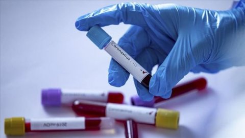 Azərbaycanda daha 588 nəfər koronavirusa yoluxdu - 7 nəfər öldü