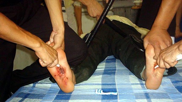 Ömürlük məhbusu döyüb, karsa saldılar