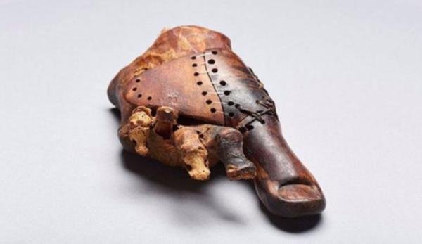 Misirdə dünyanın ən qədim protezi aşkar olunub