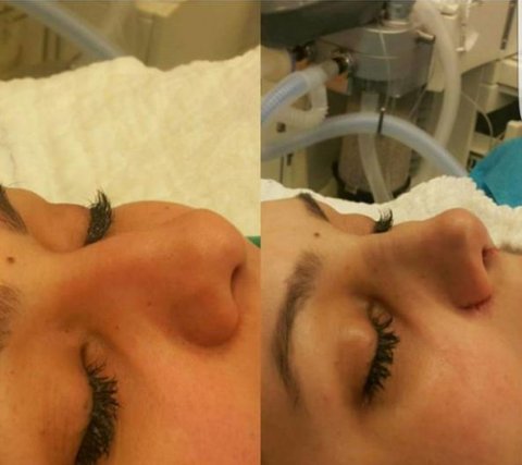 Kənan MM-in xanımı əməliyyatdan sonra belə oldu Kənan MM-in xanımı əməliyyatdan sonra belə oldu
