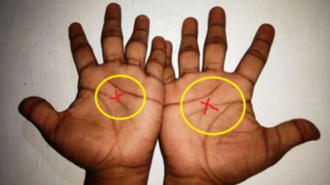 Baxın, ovucunuzun ortasında “X” işarəsi var? Baxın, ovucunuzun ortasında “X” işarəsi var?