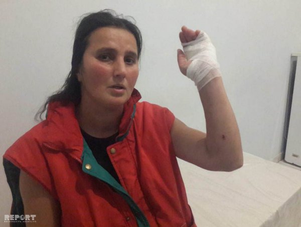 Sumqayıtda qonşu qadınlar arasında bıçaqlaşma — Yaralanan var (FOTO)