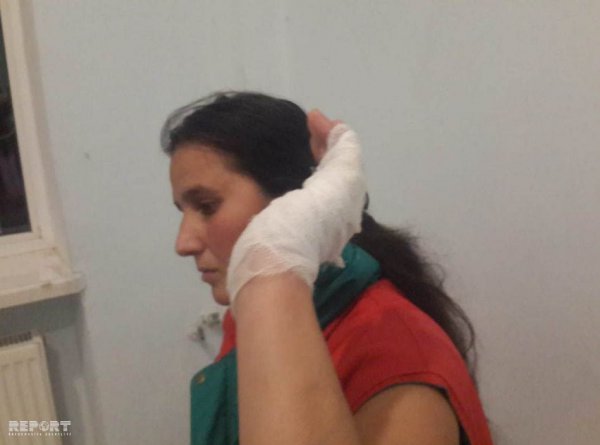 Sumqayıtda qonşu qadınlar arasında bıçaqlaşma — Yaralanan var (FOTO)