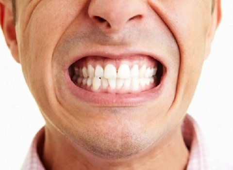 Diş qıcamasının qorxunc fəsadları