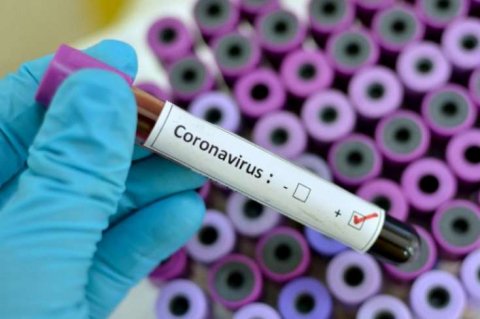 Koronavirusun asqırıq yolu ilə belə yayılır — ELMİ ARAŞDIRMA/VİDEO