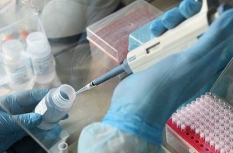 Azərbaycana koronavirusu 45 dəqiqəyə təyin edən testlər gətiriləcək