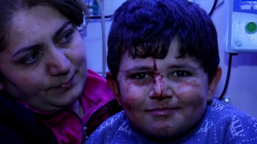 Gəncədə yaralanan uşaq: "Daşın altında qaldım" -VİDEO