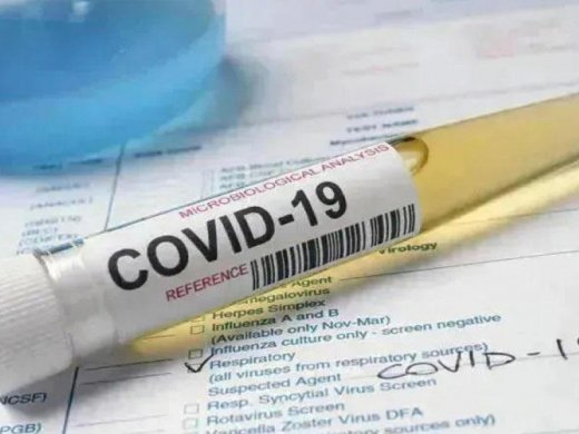 Azərbaycanda 39 nəfər koronavirusdan öldü