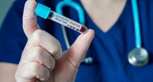 Azərbaycanda daha 19 nəfər koronavirusdan öldü: 601 yeni yoluxma 