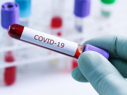 Sutka ərzində koronavirusa yoluxanların sayı açıqlandı