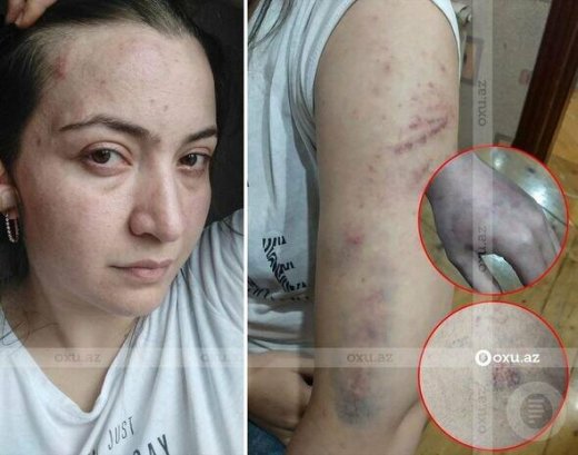 Polis şöbəsində qətlə yetirilən qadının qardaşı GİZLİNLƏRİ AÇDI - ŞOK TƏFƏRRÜAT